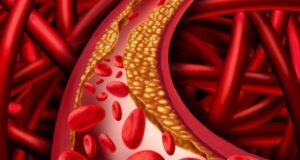 3 ВИДОВИ ХРАНА ЗА ЧИСТЕЊЕ НА КРВНИТЕ САДОВИ ОД ХОЛЕСТЕРОЛ: Доктор вели дека треба да ги јадете секој ден