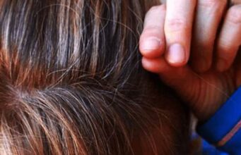 Кажете му збогум на опаѓањето на косата: Маска за зајакнување на корените по рецепт на руските лекари