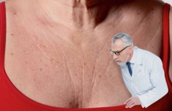 БРЧКИ НА ВРАТОТ И ДЕКОЛТЕТО – УСПЕШНО ЗАСТЕГНЕТЕ ГИ СО ЕДНОСТАВНИ МАСКИ КОИ ЌЕ ГИ НАПРАВИТЕ САМИ ДОМА