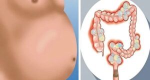 ЈАДЕТЕ ГО ОВА ЗА ВЕЧЕРА 3 ДЕНА ПО РЕД: Нема да верувате што ќе излезе од вашиот стомак…