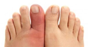 НОЗЕТЕ се ЈАСЕН ИНДИКАТОР дека нешто не е во ред! Ако вашите ПРСТИ се ЛАДНИ