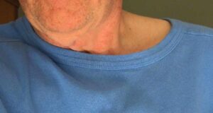 Која храна треба да се избегнува за време на срцебиење