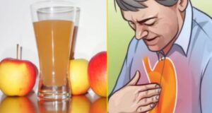 Дали страдате од жегавици? Изгаснете го на сосема природен начин со овој напиток