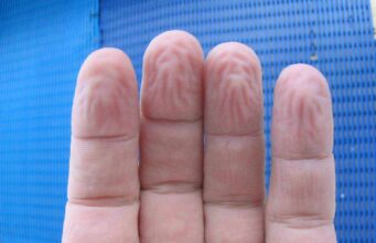 Повеќето луѓе не ја знаат вистинската причина зошто нашите прсти толку многу се збрчкаат кога се долго време во вода