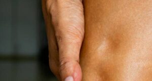 Како да препознаете тело полно со токсини? Оток, осип…