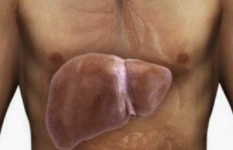 ОВА СЕ СИМПТОМИ НА ЗАСТАРЕН ЦРН ДРОБ: Вашето тело ве предупредува со овие знаци