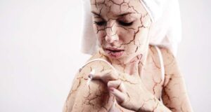 Витаминот Е ја храни кожата и го штити вашето здравје