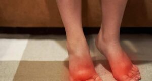 Во лето водата се акумулира во нозете и стомакот: Со помош на овој минерал ќе се оддувате како балон