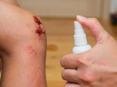 Кој е најдобриот антисептик за отворени рани?