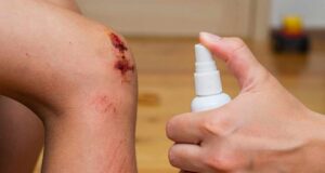 Кој е најдобриот антисептик за отворени рани?