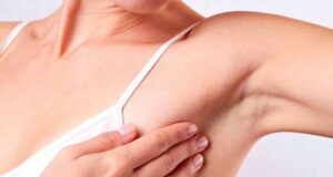 Ова се првите симптоми кои може да укажуваат на рак на дојка