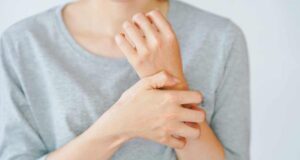 Три суптилни разлики помеѓу псоријаза и егзема