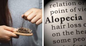 Омилениот пијалок на многумина има опасна нуспојава: Се поврзува со алопеција