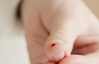 Три скриени знаци кои предупредуваат дека сте изложени на ризик од дијабетес