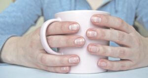 Промените во ноктите укажуваат на висок холестерол! Доколку ги забележите, веднаш посетете лекар