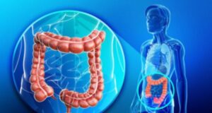 Најдобрите чаеви за синдром на нервозно дебело црево: Билни пијалоци докажани дека ги ублажуваат гасовите, надуеноста, грчевите…