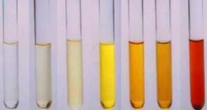 Што открива урината за вашето здравје? Оваа боја е знак за предупредување