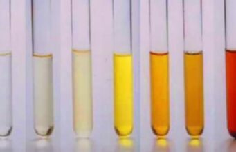 Што открива урината за вашето здравје? Оваа боја е знак за предупредување