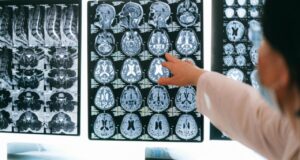 Невролозите никогаш не јадат оваа храна: Една што Македонците ја обожаваат е на листата