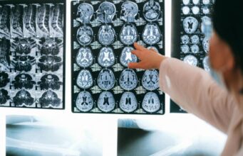 Невролозите никогаш не јадат оваа храна: Една што Македонците ја обожаваат е на листата