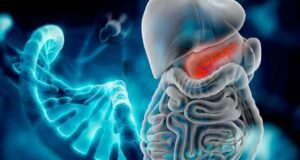 Навиката што го зголемува ризикот од најсмртоносен рак: Многумина редовно прават грешки – обрнете внимание