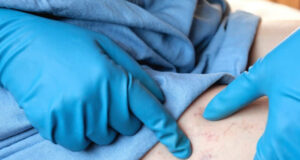 Симптоми кои укажуваат на присуство на тромб во телото