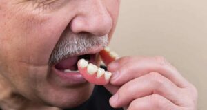 Неверојатно сознание: Мозокот старее понатаму по секое вадење заб, еве колку