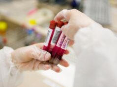 Симптоми за кои треба да направите крвна слика