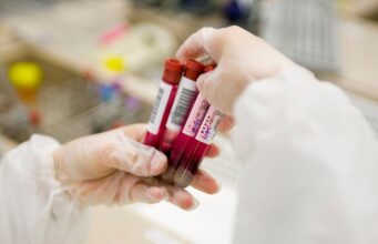 Симптоми за кои треба да направите крвна слика