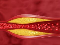 Тивок убиец во крвта: Кардиолозите тврдат дека 1 промена го чисти телото од лошиот холестерол