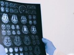 Првиот знак дека мозокот ослабува: Штом забележите една промена, сте на пат кон Алцхајмерова болест