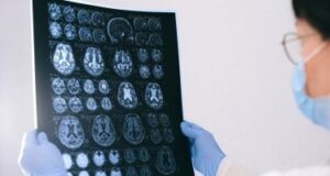 Првиот знак дека мозокот ослабува: Штом забележите една промена, сте на пат кон Алцхајмерова болест