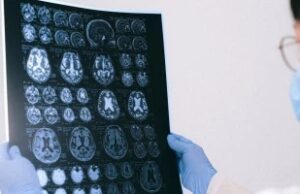 Првиот знак дека мозокот ослабува: Штом забележите една промена, сте на пат кон Алцхајмерова болест