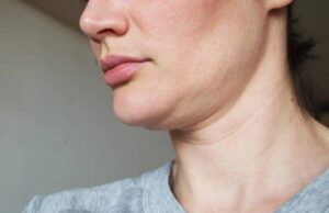 Природни начини за ублажување на брчките на вратот