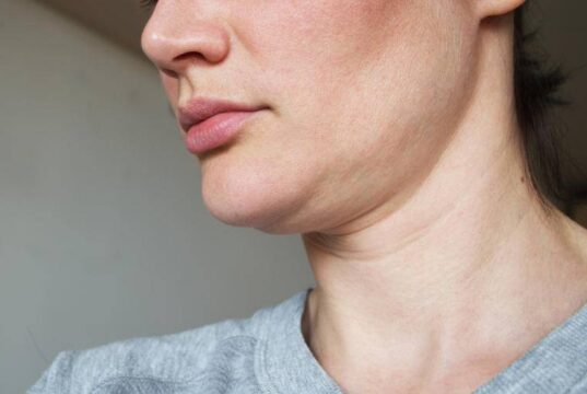 Природни начини за ублажување на брчките на вратот