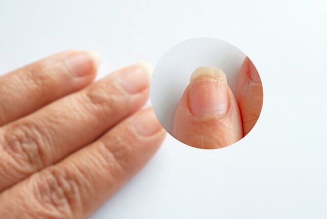 891d3ee1-8000-4e26-b86c-53a40c05f876