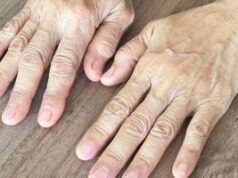 Знаци кои предупредуваат на лоша циркулација: Ја припишуваме на замор и стрес, а состојбата е многу посериозна