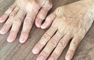 Знаци кои предупредуваат на лоша циркулација: Ја припишуваме на замор и стрес, а состојбата е многу посериозна