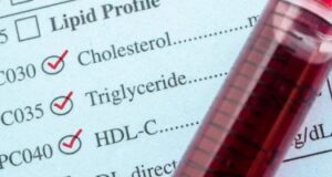 Решете ги високите триглицериди без лекови: Комбинација која е докажано ефикасна – ќе бидете изненадени од резултатите