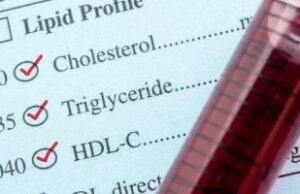 Решете ги високите триглицериди без лекови: Комбинација која е докажано ефикасна – ќе бидете изненадени од резултатите