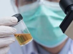 Дали се чувствувате уморни, имате главоболка и имате темна боја на урина? Еве што ви кажува вашето тело