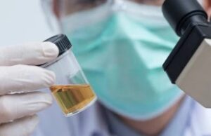 Дали се чувствувате уморни, имате главоболка и имате темна боја на урина? Еве што ви кажува вашето тело