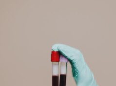 Тромбофилија: тивок убиец кој влијае на бременостите и го напаѓа срцето