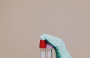 Тромбофилија: тивок убиец кој влијае на бременостите и го напаѓа срцето