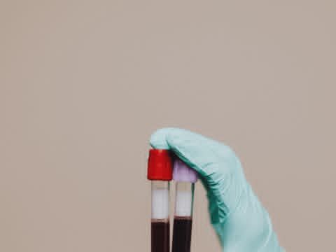 Тромбофилија: тивок убиец кој влијае на бременостите и го напаѓа срцето