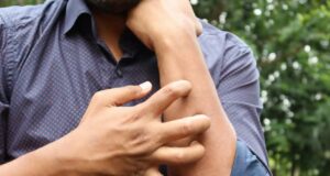 Ако ве касне комарец, смирете го чешањето со оваа евтина храна: Црвенилото ќе исчезне за кратко време