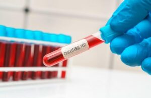 Едноставен пијалак наутро ги раствора мастите од црниот дроб и го намалува холестеролот: Еве што прават луѓето погрешно кога го пијат